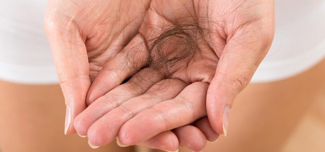 Rụng tóc nhiều có phải tình trạng đáng lo và nguyên nhân do đâu? - Ảnh 1.