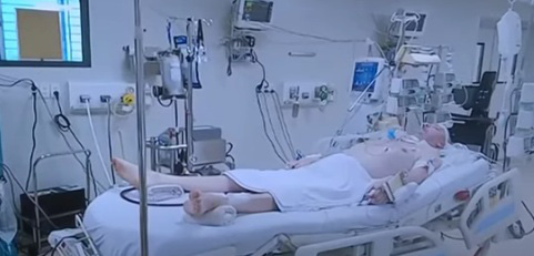Bệnh nhân phi công người Anh mắc Covid-19 nặng nhất Việt Nam: Muốn ghép phổi cần những điều kiện gì? - Ảnh 1.
