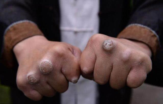 Màn thách đấu gây chấn động võ lâm của Chưởng môn phái Thanh Thành với Mike Tyson - Ảnh 5.