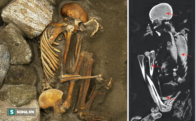 Phát hiện khảo cổ quái dị: Xét nghiệm ADN cho thấy xác ướp 3000 tuổi được 'chắp vá' từ 6 di thể