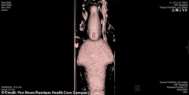 Các nhà khoa học không thể tin vào mắt mình khi nhìn ảnh chụp CT xác ướp 3000 tuổi, bên trong có gì vậy? - Ảnh 2.