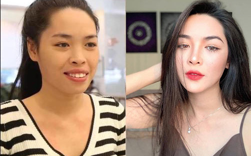 Hot girl phẫu thuật thẩm mỹ Vũ Thanh Quỳnh sau 7 năm lột xác: Lộng lẫy hơn, giàu có thêm