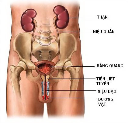 Căn bệnh chỉ đàn ông mắc, không điều trị sớm có thể tử vong: Cách giảm nguy cơ ít tốn tiền - Ảnh 1.