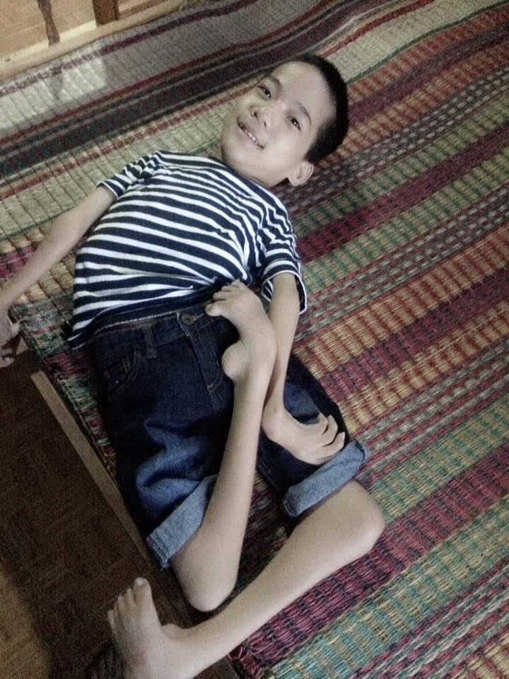 Chàng trai khuyết tật 20 năm, vực động lực sống nhờ âm nhạc: Muốn làm mẹ tự hào - Ảnh 3. Chàng trai khuyết tật 20 năm, vực động lực sống nhờ âm nhạc: Muốn làm mẹ tự hào - Ảnh 3.