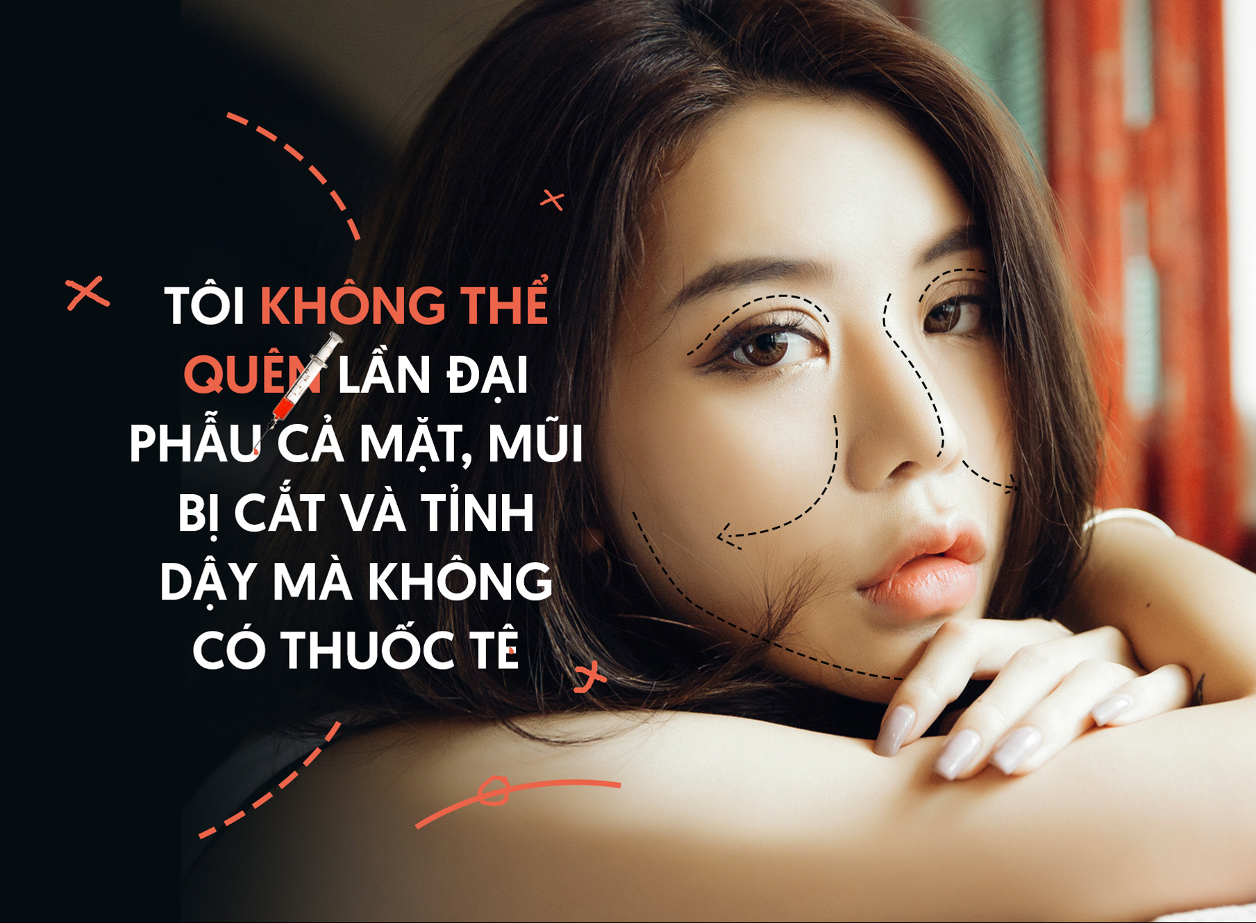 &quot;Hot girl thẩm mỹ&quot; Hạt Mít: Không thể quên lần đại phẫu cả mặt, mũi bị cắt và tỉnh dậy mà không có thuốc tê