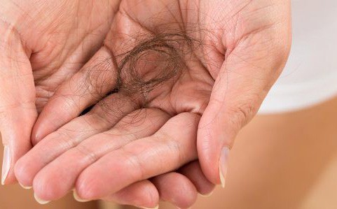 Rụng tóc nhiều có phải tình trạng đáng lo và nguyên nhân do đâu?