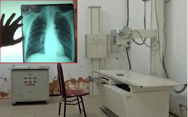 Bé gái nghi bị hiếp dâm trong phòng X-quang: Chụp chiếu tim, phổi nhưng bắt cởi cả quần lót...