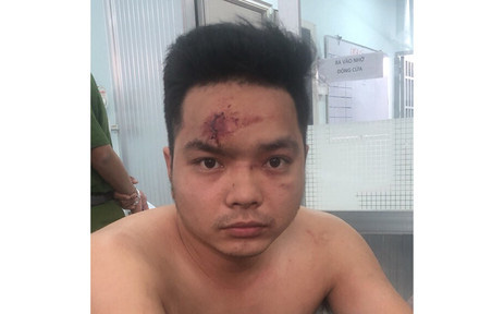 Bị kiểm tra, thanh niên dùng bình xịt hơi cay tấn công CSGT ở Sài Gòn