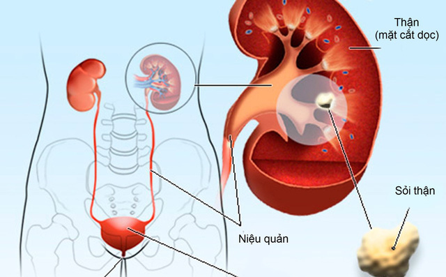 Bác sĩ khoa Thận nhắc bạn 6 điều quan trọng giúp thận khoẻ, tránh được các bệnh về thận