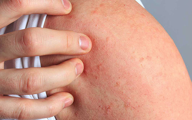 Tham khảo bí quyết ổn định men gan từ người đàn ông thường xuyên uống rượu bia
