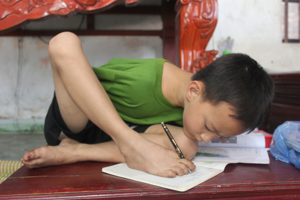 Bà ung thư chăm cháu tàn tật: BS dặn bồi bổ nhưng tôi còn phải nhường đồ ngon cho cháu - Ảnh 2. Bà ung thư chăm cháu tàn tật: BS dặn bồi bổ nhưng tôi còn phải nhường đồ ngon cho cháu - Ảnh 2.