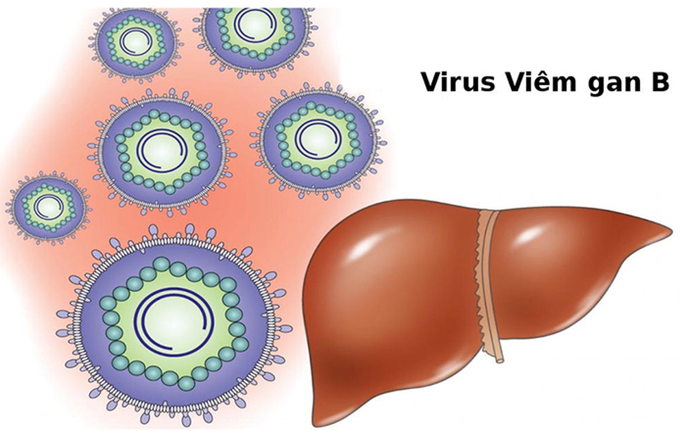 Sở Y tế TP HCM khuyến cáo tình trạng trẻ mắc viêm gan cấp chưa rõ nguyên nhân - Ảnh 1.