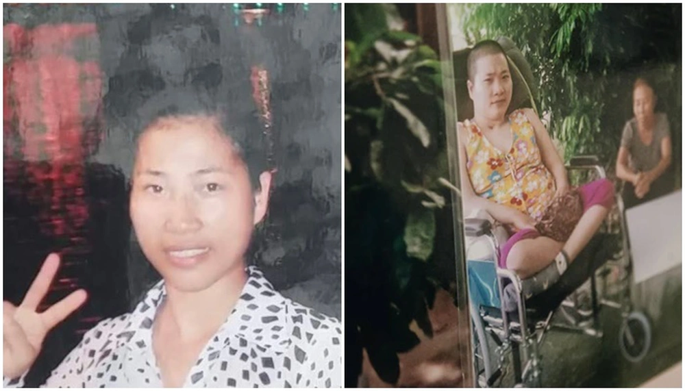 Hoài bão dang dở của cô gái Karatedo bị tai nạn gãy xương quai hàm, mất 8 chiếc răng... - Ảnh 2.