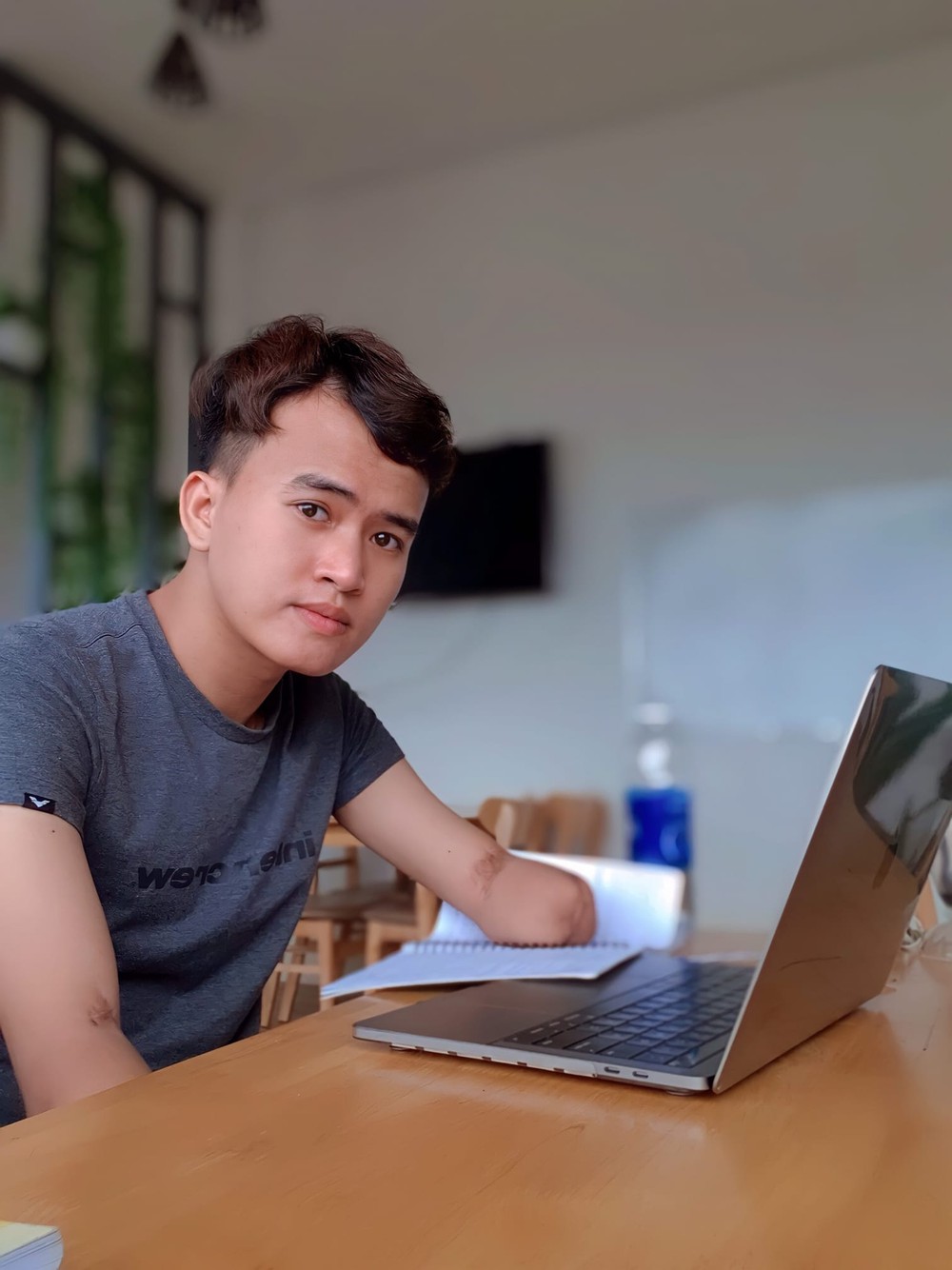 Nỗ lực phi thường của chàng cụt yêu đời sau cú ngã từ trên mái nhà  - Ảnh 1.