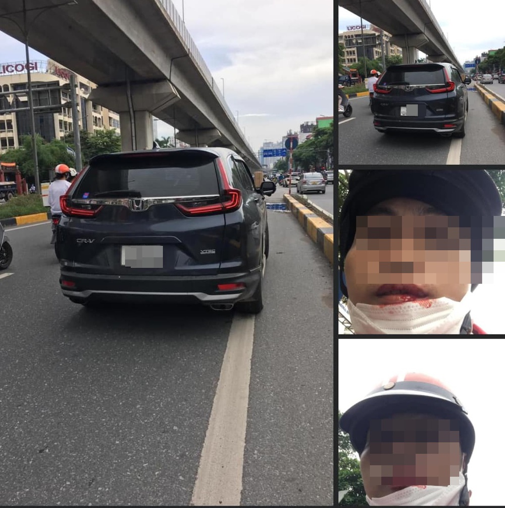 Nam shipper tố bị tài xế ô tô đánh gãy răng: Bấm còi đòi vượt, nhưng tôi không nhường - Ảnh 1.