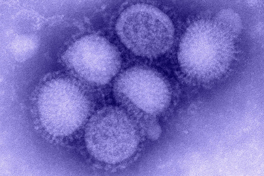 6 nhóm người có nguy cơ chuyển nặng khi mắc cúm - Ảnh 1.
