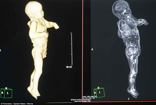 Chụp CT thi thể ‘hóa đá’ của nạn nhân thảm họa Pompeii: ‘Cái chết của họ quá khủng khiếp’ - Ảnh 4.