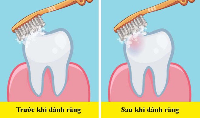 Các nha sĩ trả lời câu hỏi dễ mà khó: Nên đánh răng trước hay sau bữa ăn sáng? - Ảnh 3.